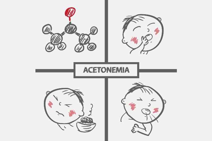 Acetonemia