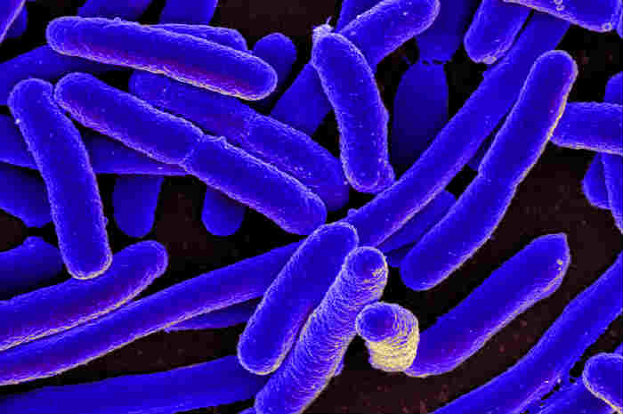 Antibioticoresistenza e germi sentinella