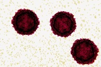 Eosinofilia