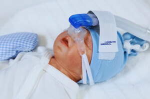 Bubble CPAP o CPAP a bolle