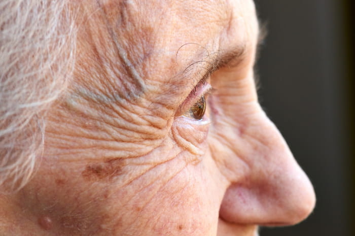 stato salute anziani