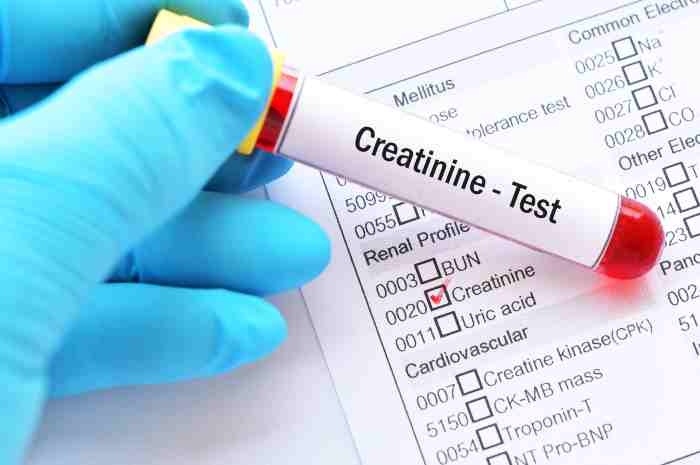 Constructing Relationships With Creatine Monohydrate