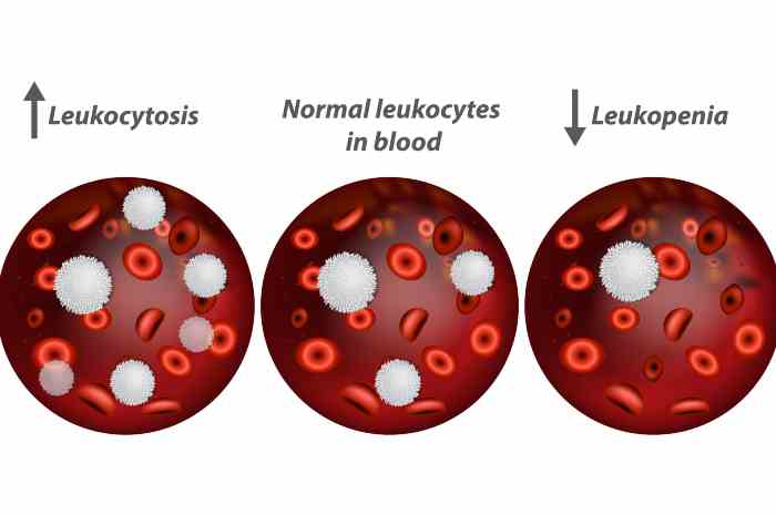 Leucocitosi