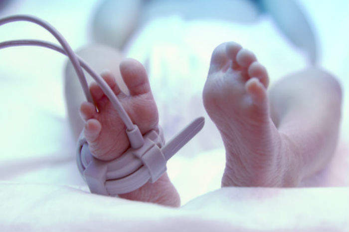Malattia emolitica feto-neonatale - MEFN