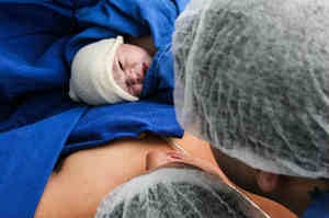 Assistenza al parto extraospedaliero