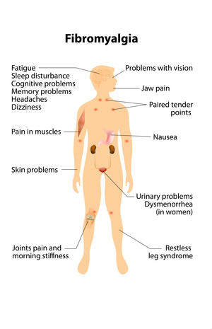 Fibromialgie și dureri în piept: Ce este normal, simptome și tratament