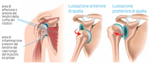 Ortopedia: Aumenta offerta servizi "Infermi” Biella